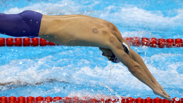 Hacamat Yaptıran Ünlü Yüzücü Michael Phelps ve Altın Madalya
